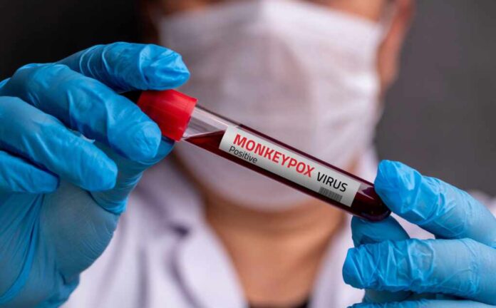 Doctor,Wearing,Medical,Gloves,Holding,A,Blood,Tube,With,Positive