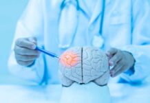 Dementia Slashed 45%–No Drugs Needed! Doctor examining a model of a brain with a pen