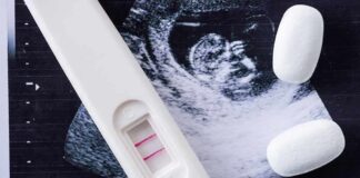 Pregnancy test with two lines on an ultrasound print